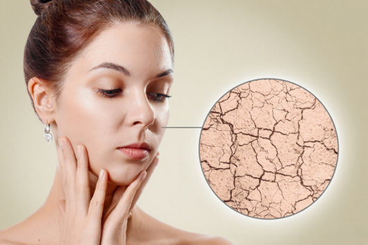 Is the Sauna Good for Your Skin?